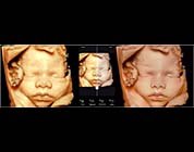 Enhanced Visualization