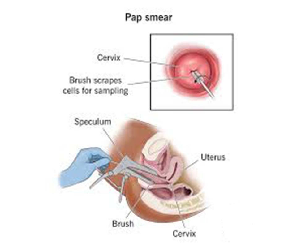 Pap Test