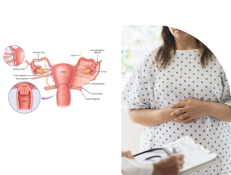 Vaginal Hysterectomy