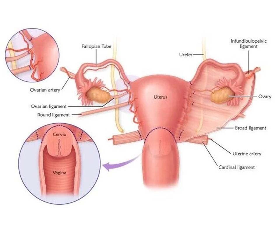 Vaginal Hysterectomy